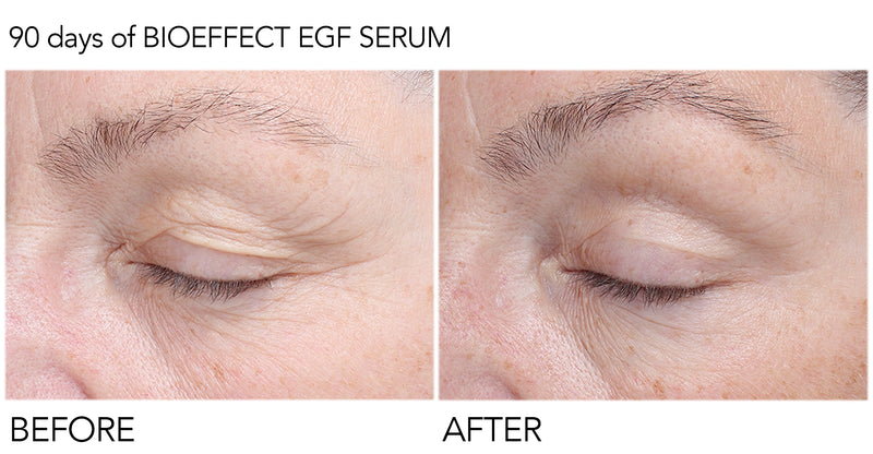 EGF Serum