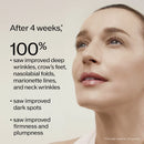 Vital Perfection - Intensive WrinkleSpot Treatment A+