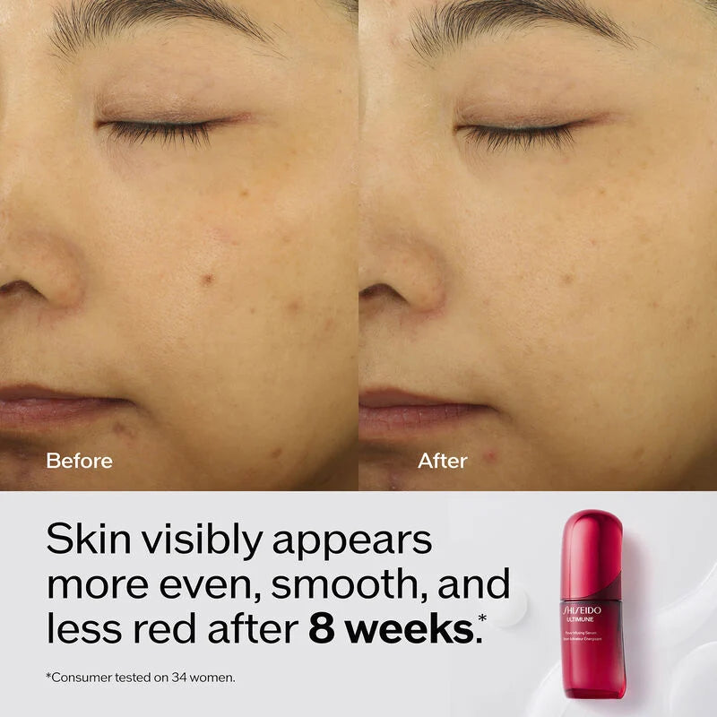 Ultimune 4.0 - Power Infusing Serum