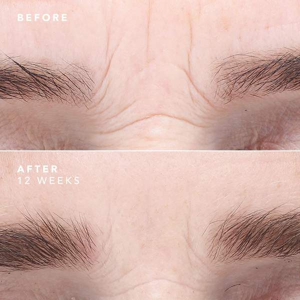 EGF Serum