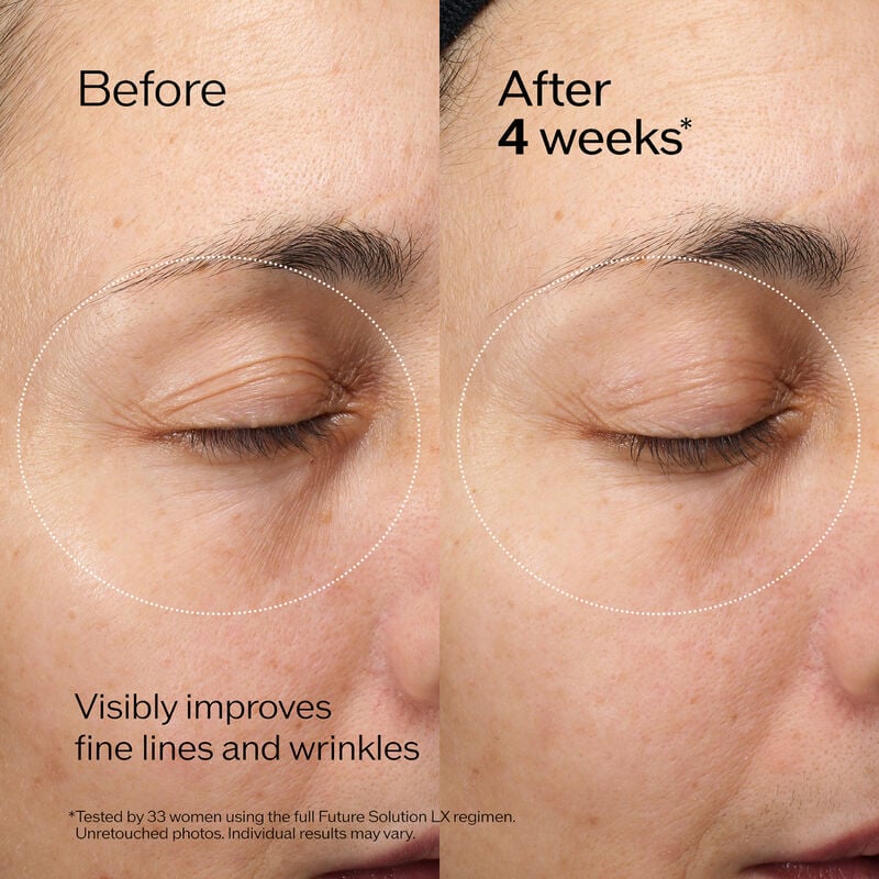 Future Solution LX - Eye and Lip Contour Regenerating Cream